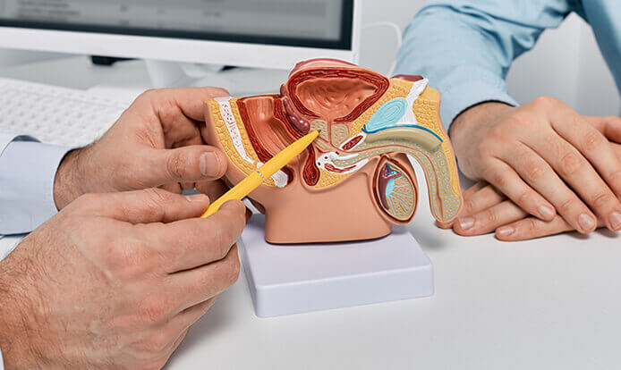 Doctor explaining an enlarged prostate using a model