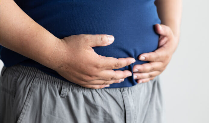 Man with obesity, a symptom of kidney cancer
