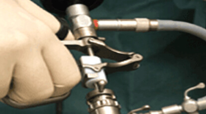 What You Need To Know About Lasers In Urology