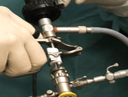 Lasers In Urology