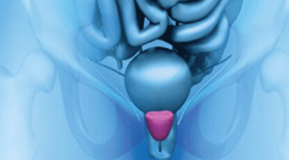 Understanding Men's Health: Prostate