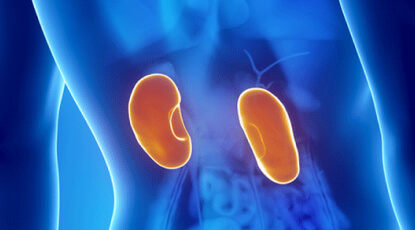 The pain of kidney stones from a personal experience