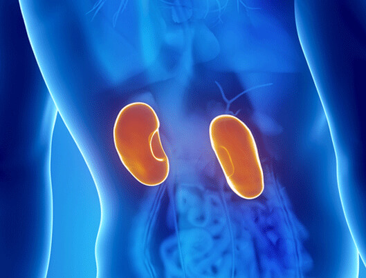 The Pain of Kidney Stones from a Personal Experience!